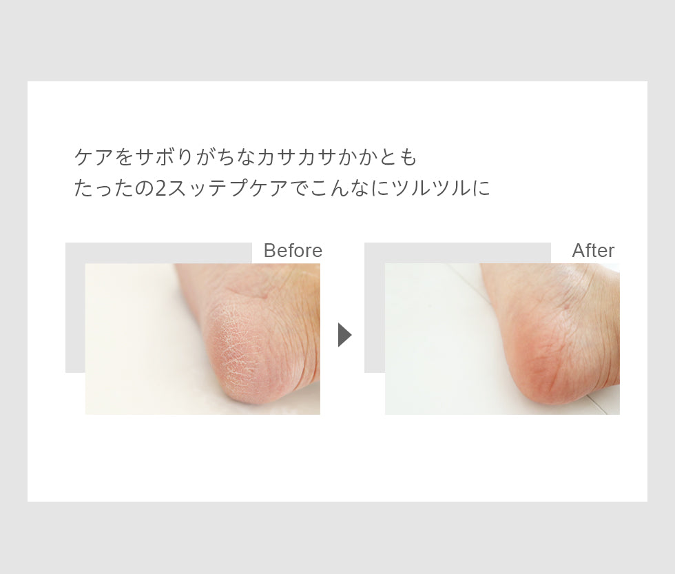 かかとケア お得な3点セット ボディスクラブ 靴下 濃厚保湿クリーム